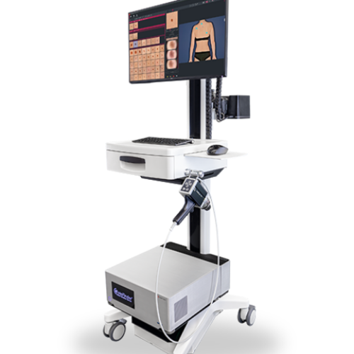 Revisión digital de lunares